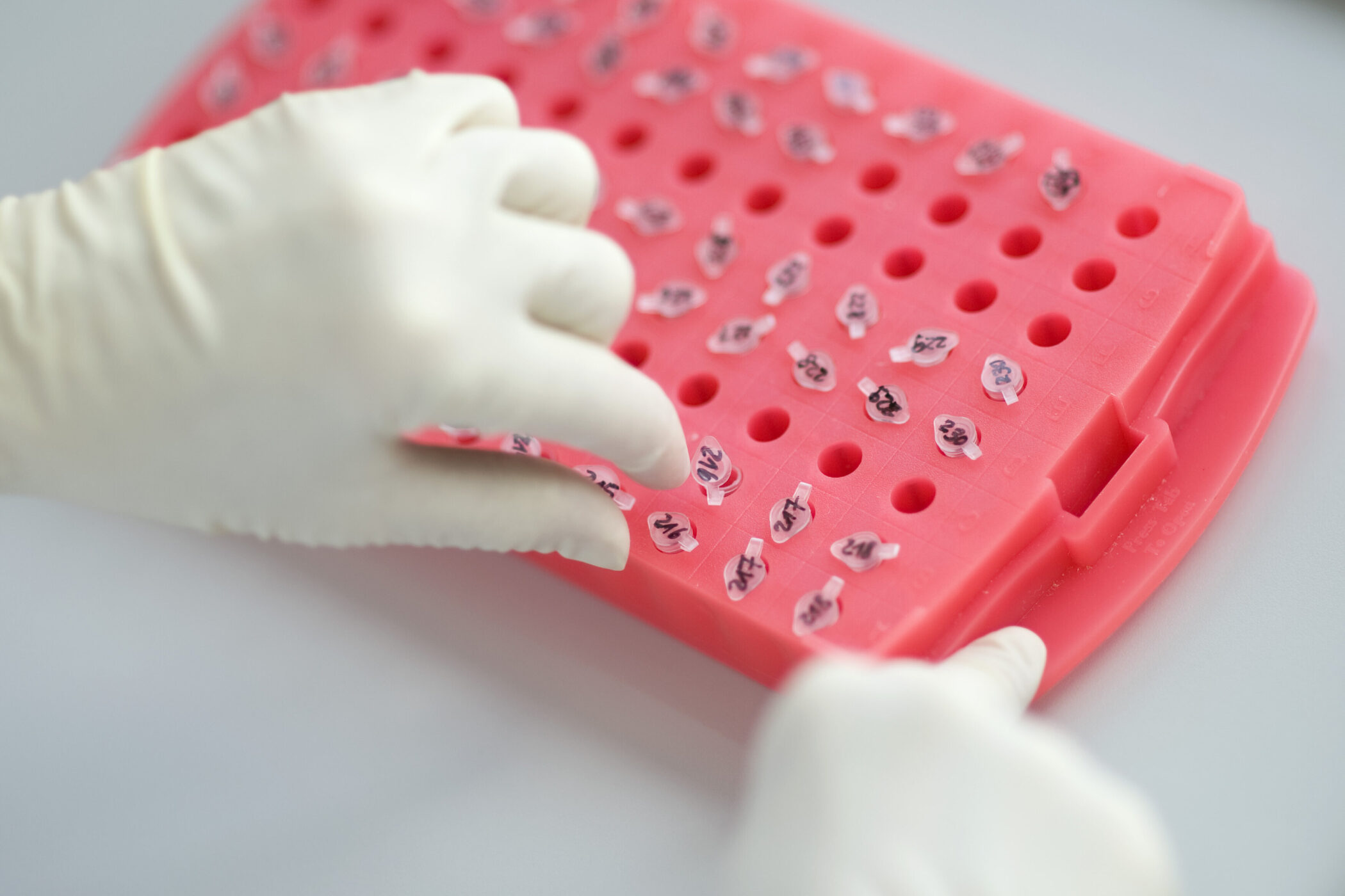 Hände mit Handschuhen halten eine rosa Halterung mit nummerierten Probenröhrchen.